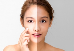 A Deep Dive into Neutro Skin Whitening Injections: Benefits, Risks, and Alternatives