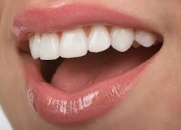 Transform Your Smile with E-Max Veneers in Riyadh