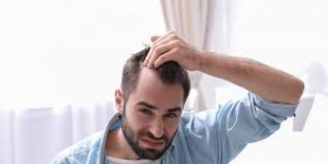 Hair Restoration Excellence: Transplants in Riyadh