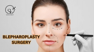 Eyelid Surgery: A Comprehensive Guide to Blepharoplasty