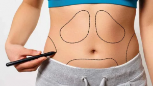 Liposuction: A Guide to Choosing the Right Clinic in Abu Dhabi