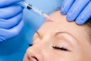 Botox Injections for a Refreshed Appearance in Abu Dhabi