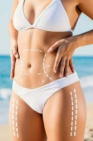 The Cost Breakdown: What You Need to Know About Body Liposuction in Riyadh