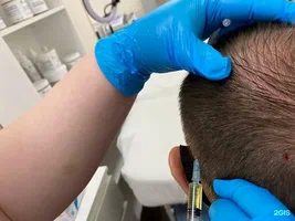 The Role of Genetics in Hair Transplantation Success in Abu Dhabi