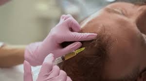 The Patient Experience with PRP Hair Treatment in Dubai