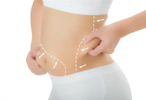 The Science Behind Non-Surgical Fat Reduction