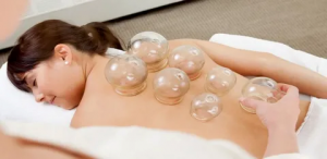 Cupping Therapy in Dubai: A Natural Approach to Wellness