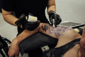 Tattoo Removal: How It Works