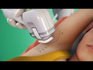 Explore the Miradri Treatment Experience: What Patients Should Expect