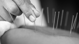 Discover the Benefits of Remedial Massage Therapy in Bayside Melbourne