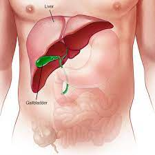 Which Surgery is Best for Gallbladder Stone?