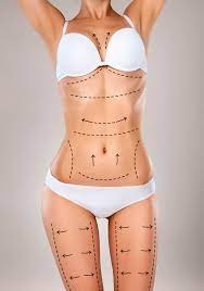How to Determine the True Cost of Liposuction in Riyadh