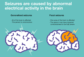 What is the role of Gabapentin in pain management?