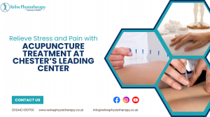 Relieve Stress and Pain with Acupuncture Treatment at Chester’s Leading Center