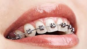 Orthodontics near Wantirna