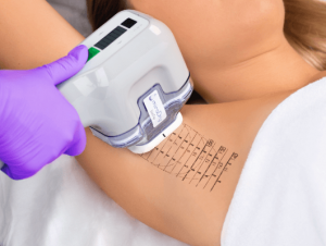 How Miradri Treatment Can Revolutionize Your Skincare Routine