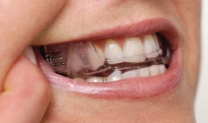 Affordable Dental Devices in Riyadh: Get Professional Results at Home