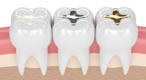 Riyadh Dental Fillings Cost Guide: Everything You Should Know