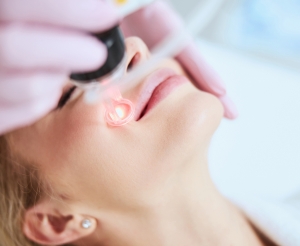 Hidden Costs of Fractional CO2 Laser in Dubai