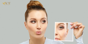 How Does Skin Rejuvenation Help Reduce Wrinkles?