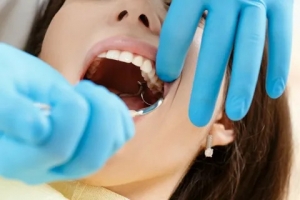 How to Select the Right Oral Surgeon for Wisdom Tooth Extraction