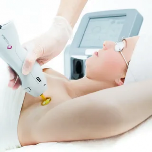 How Laser Hair Removal Works in Abu Dhabi