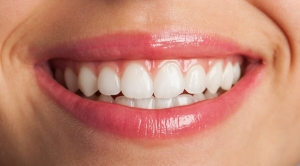 5 Tips for Getting the Best Results from Veneers