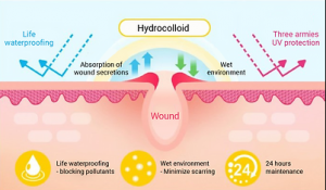 Can Hydrocolloid Acne Patches Help With Scarring