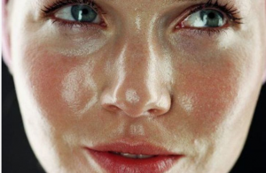 5 Reasons to Love Niacinamide for Oily Skin
