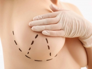 The Long-Term Effects of Breast Enhancement Surgery