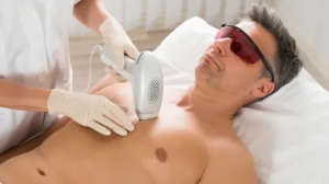 Exploring the Safety of Laser Hair Removal Treatments