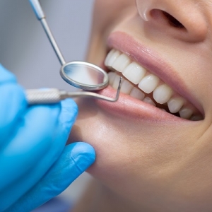 How to Find a Clinic That Offers Affordable Teeth Whitening