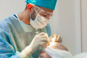 Hair Transplantation vs. Hairpieces: A Comparison for Abu Dhabi Residents