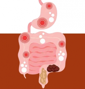 Advanced Drug Delivery Strategies for Inflammatory Bowel Disease