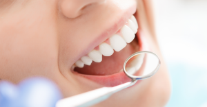 A Guide To Invisalign Service in Vancouver, BC, and Family Dentist