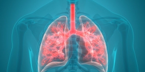 Understanding Idiopathic Pulmonary Fibrosis: An Overview