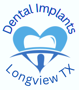 Discover the Benefits of Dental Implants and Regular Dental Cleaning in Longview, TX