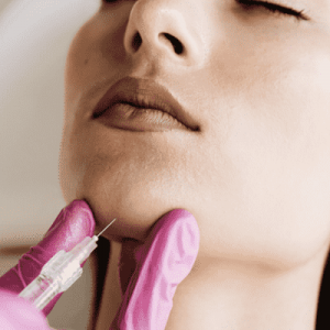 Jawline Fillers: What Makes a Clinic the Best Choice?