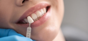 Get Prepared: Know the Costs of Dental Fillings in Riyadh Before Your Appointment