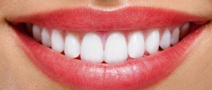 Discover the Secret to a Perfect Hollywood Smile in Riyadh