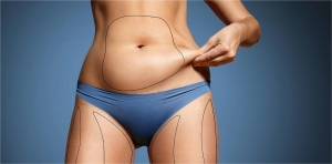Mini Abdominoplasty in Abu Dhabi: Confidence in Every Curve!