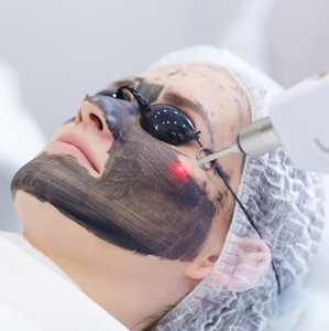 Find Your Radiance: Laser Carbon Peel Revealed