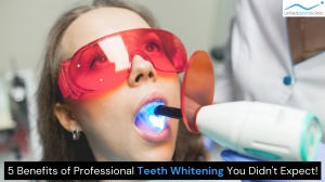 Unlock a brighter smile: 5 surprising benefits of professional teeth whitening!