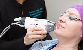 Who is a Good Candidate for Fraxel Laser Treatment?