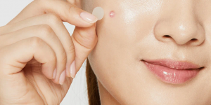 How Salicylic Acid Pimple Patches Help You Fight Breakouts