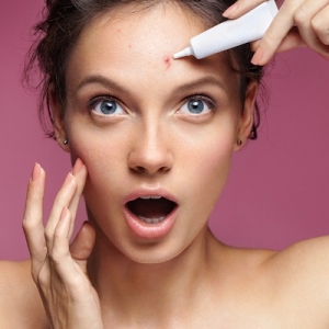 Acne Treatment In Muscat