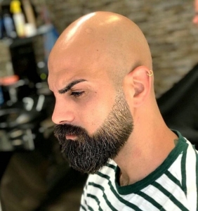 Achieve a Bold Look with Beard Hair Transplant
