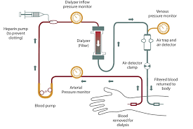 Understanding Hemodialysis Cost in India