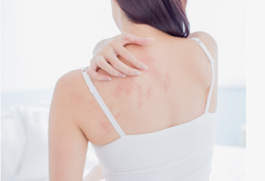 Refresh and Renew: Discover Our Salicylic Acid Body Wash