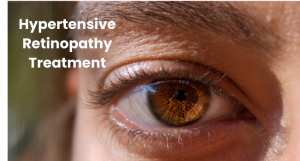 Hypertensive Retinopathy Treatment